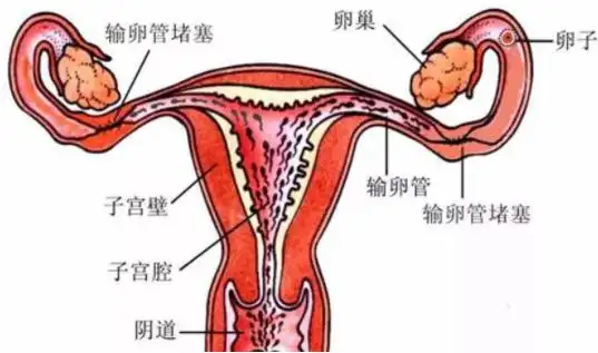 盆腔炎和附件炎有区别吗
