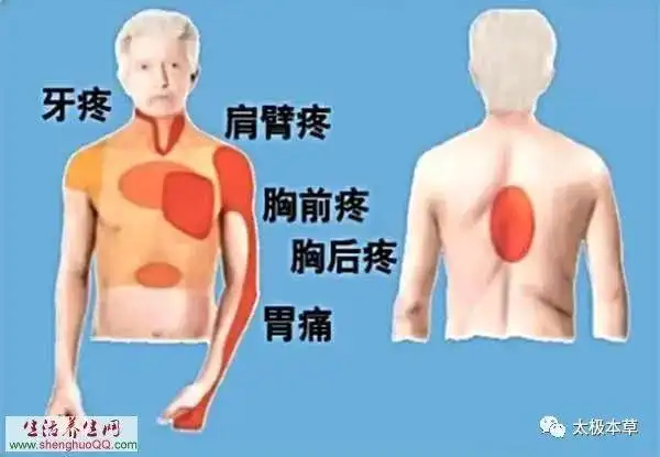 肩膀痛,胃痛,后背痛有可能是心脏病导致的,注意了|牙痛|冠心病|牙疼