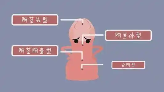 尿道下裂是一种男性尿道开口位置异常的先天缺陷,尿道口可分布在正常