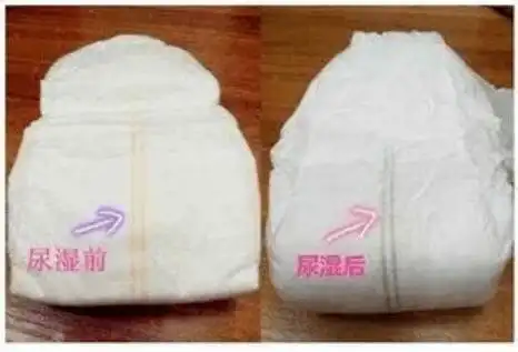 5岁以下高发女宝宝有这4种表现很可能是外阴炎越早就医越好