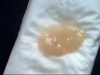 怀孕20天大的胎儿多大