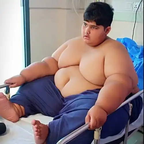 全球最胖男孩:10岁重达394斤,胃口超好,肚子像个无底洞