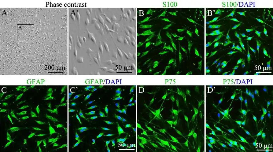 isolationandpurificationofschwanncellsfromspinalnerveso