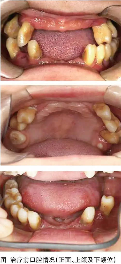 糖尿病专科医生责无旁贷