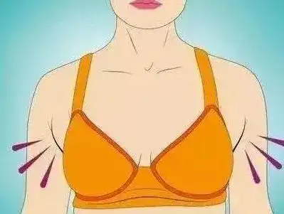 副乳是癌前兆?9102年了,别再被忽悠了