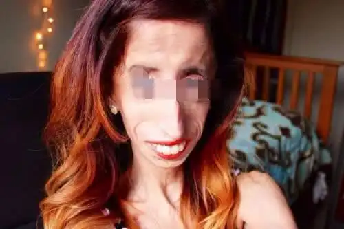 因为长得丑打破吉尼斯纪录,位居世界前三的丑人,丑出新境界!