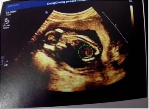 只是看到图片有一处不明白是什么,所以想知道.