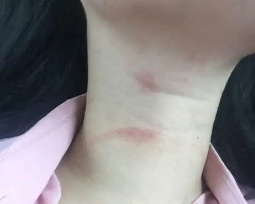 女儿脖子上惊现吻痕,父母大怒,网友:养孩子不能只给钱