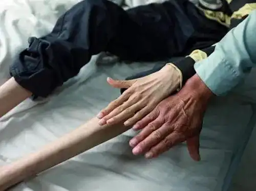 患者杜某患马凡氏综合征,于2014年11月进行过 bentall手术,二尖瓣机械