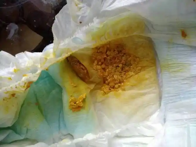 这粑粑正常吗?怎么感觉有的偏白