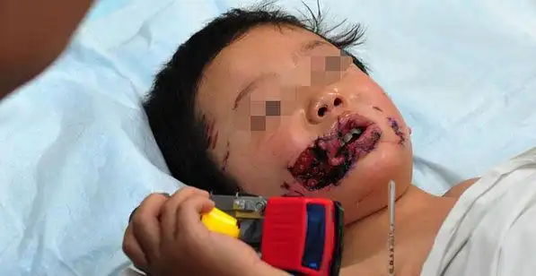 由哈尔滨市公安局,市畜牧兽医局联合发布的通告,对犬只登记,备案,免疫