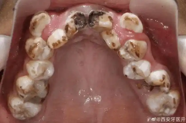 c罗都喊你别喝可乐了,一起多喝白开水吧!