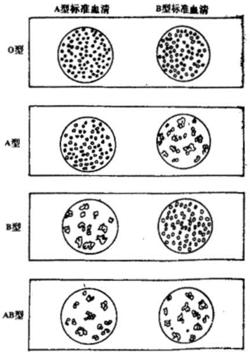 把四人的血液分别用a型.b型标