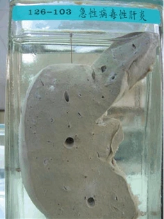 【图】病理期中大体标本整理(三)