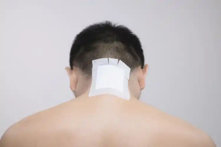 苗玉堂膏药颈椎疼痛贴敷示意图