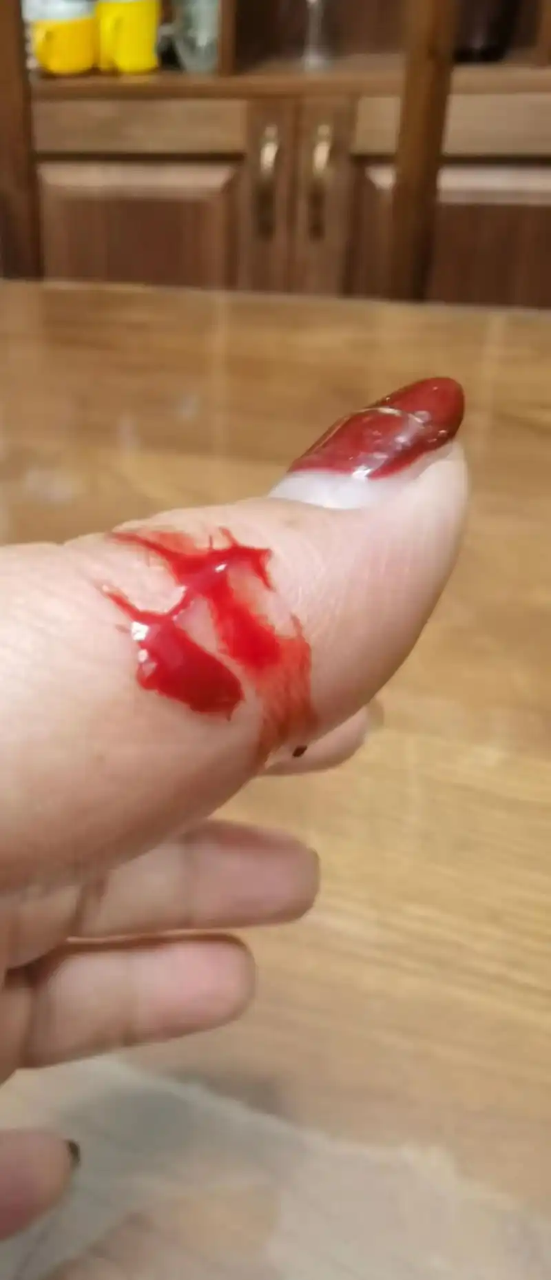 一大早干活把手指划破,一查好兆头,如果左手的拇指被划伤,那么 - 抖音