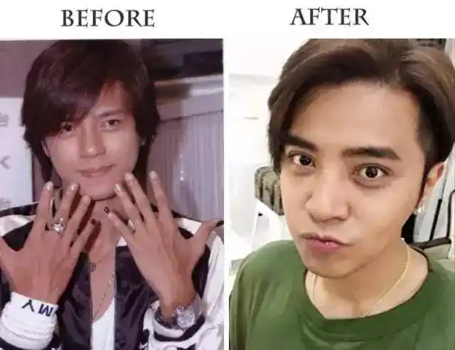 罗志祥↑↑↑小猪并非天生双眼皮,为了拥有一双迷人电眼,从以前到现在