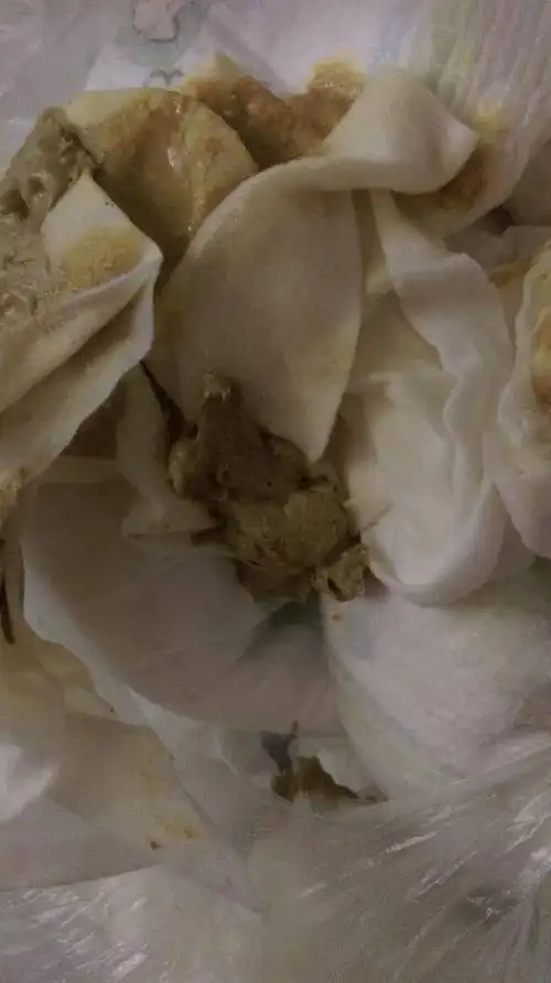 麻烦各位大神看看我宝宝便便怎么这个颜色啊?像陶土颜色一样