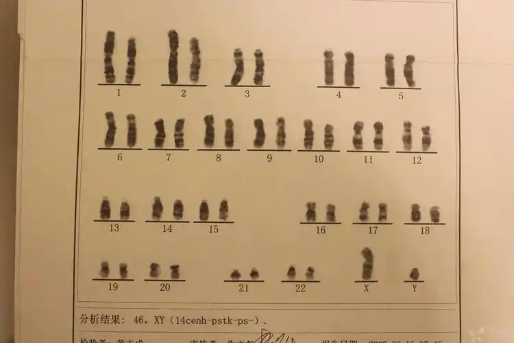 育儿网站!性染色体异常是什么原因"灯火辉煌"-第2张图片-西安论坛资讯