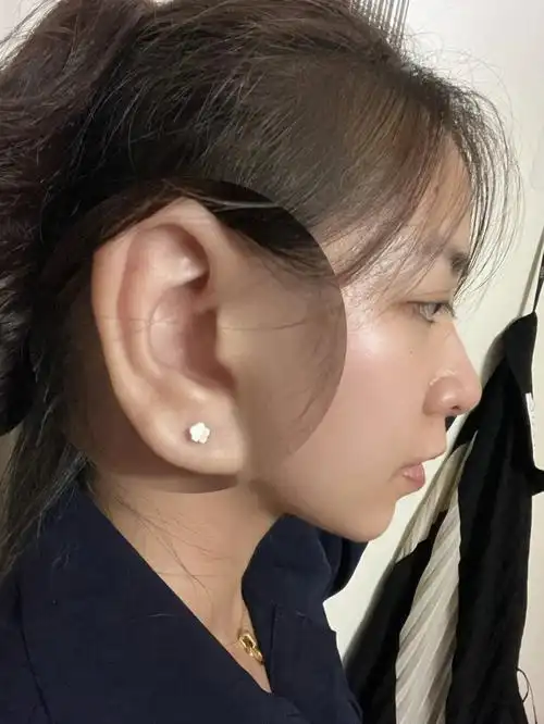 做夏天打耳洞的勇士:"痛快!