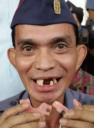 梦见自己牙齿掉了