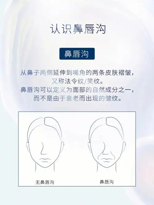 你的鼻唇沟什么程度鼻唇沟的判断美化