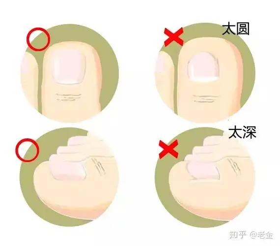 怎样正确剪指甲