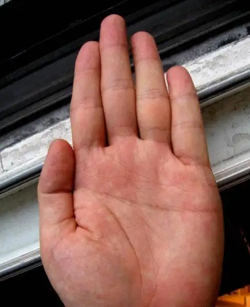 关于断掌有两种说法:「左断掌官运佳,右断掌克六亲」,「左断掌握兵符