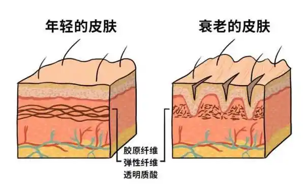 随着年龄的增长及熬夜等各种伤害皮肤行为,细胞外基质的含量逐渐减少