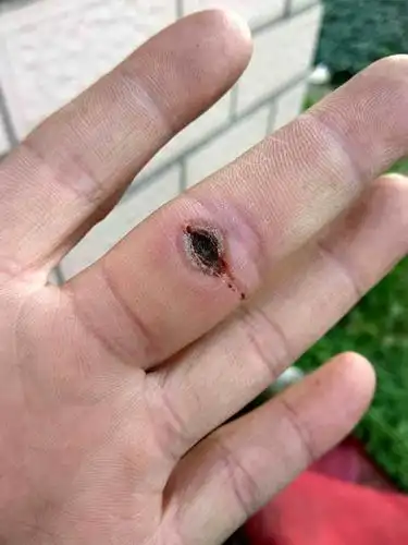 空手指_kds宽带山