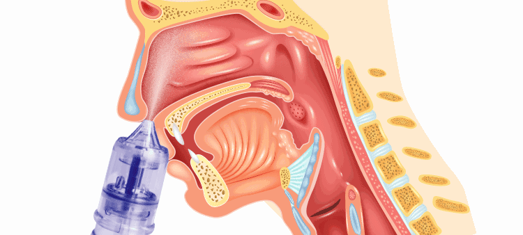 电动式儿童洗鼻器家用鼻腔冲洗鼻炎喷雾式自动泄压官方标配送60小包洗