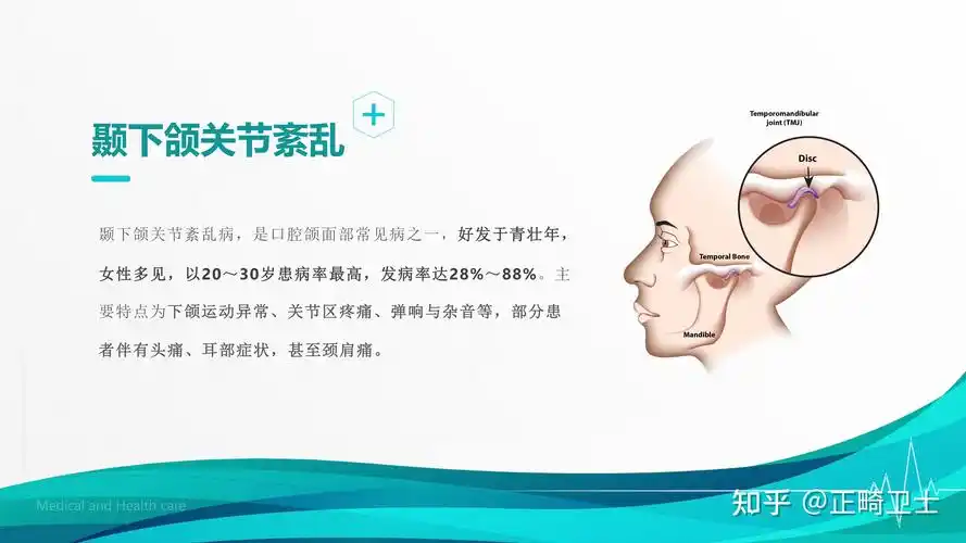 颞下颌关节紊乱病是口腔颌面部常见病之一好发于青壮年女性多见