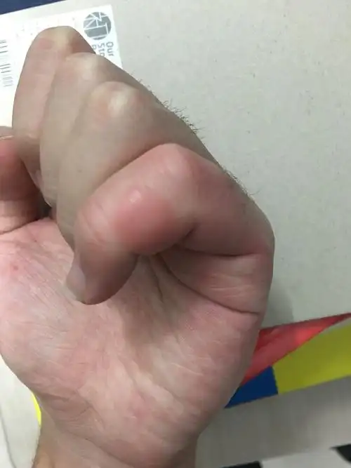 被蟑螂咬是一种什么体验? - 知乎