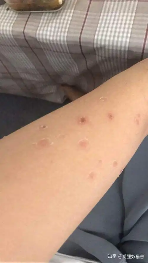 猫与人得了猫藓怎么办快速康复的技巧告诉你