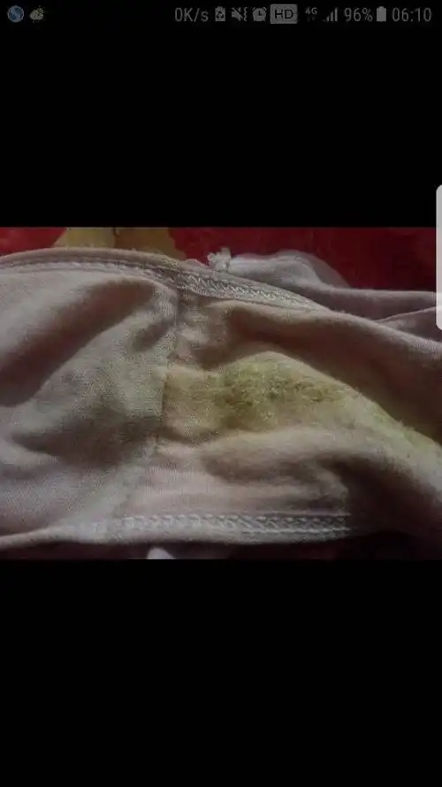 老婆内裤上怎么会有这个 请各位大哥大姐帮我看看是什么 没分了 帮