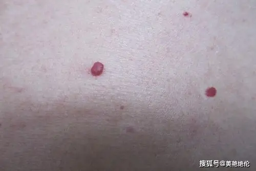 关于朱砂痣,坊间有很多的传闻,说什么这是上辈子的爱人为你留下的记号