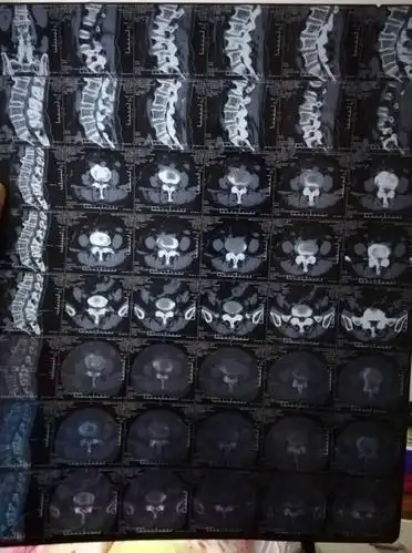 去医院做x光,ct,核磁都检查不出问题来,最后下个定论腰肌劳损.