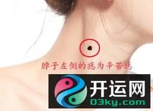脖子上有黑痣是代表好还是坏的象征