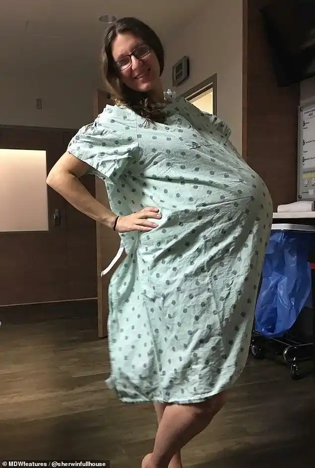 医生惊呆了美女子患多囊卵巢综合征后产下5胎