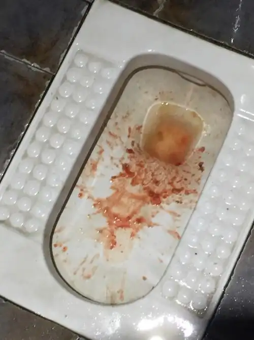 今天喝酒,3瓶多,然后吐了,有红色是吐血吗