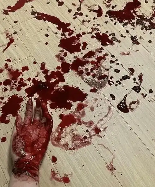 aoa权珉阿发文吐槽精神科护士招致恶评深夜晒割腕照泄愤