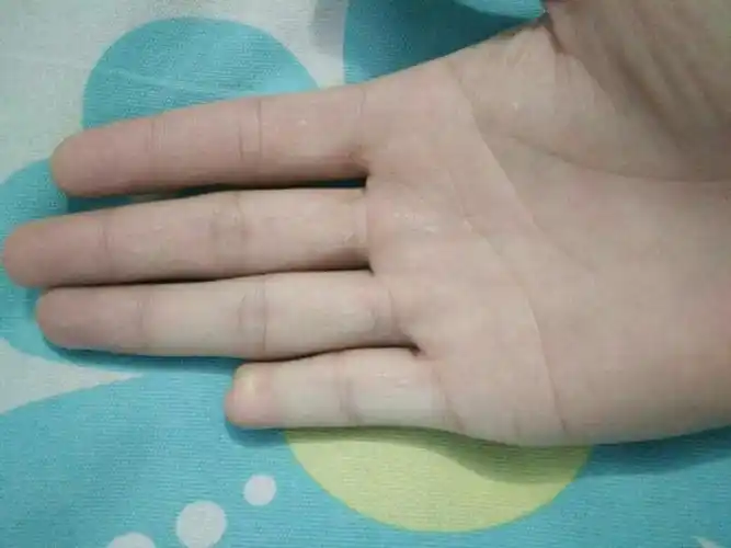 请问右手小拇指缺少一小节可以参考公务员公安吗?