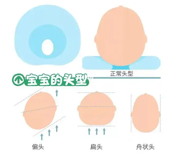 另一侧则相对突出,出现偏头的情况;如果长期平躺,后脑勺又会变得扁平
