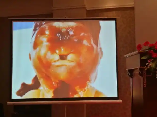 全前脑(一)一一严英榴