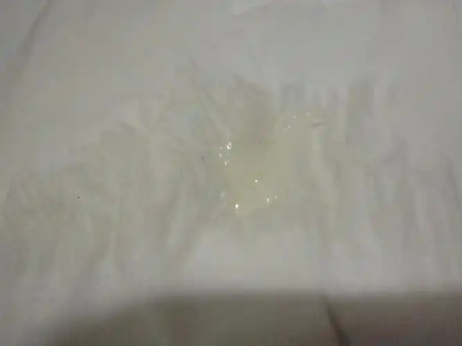 安全!同房后液体流出来影响怀孕吗?"落落大方"-第2张图片-琳权网