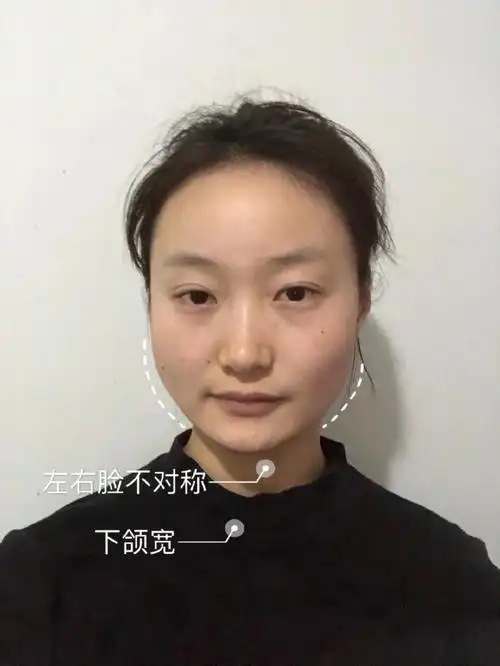 120斤的大饼脸如何变成90斤上镜脸