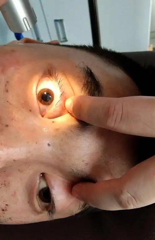 花溪区人民医院神经外科