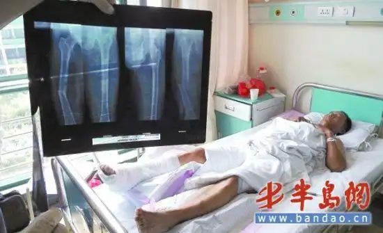 男子装车出意外千斤玻璃砸断腿 包工头表示担责