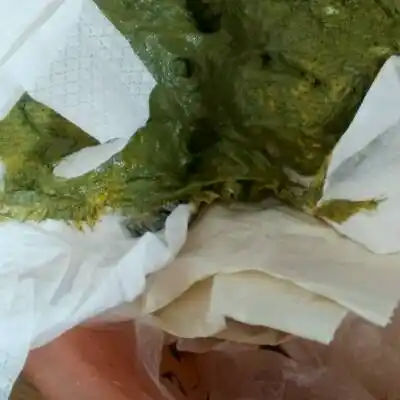 拉绿黑色的大便,是怎麼回事,这样好吗,我们吃母乳和奶粉,有给我家宝宝