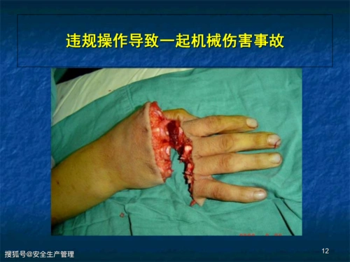 机械安全生产基本知识及事故防范